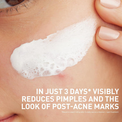 CeraVe Clay To Foam Acne Face Wash, Multi-Use Salicylic Acid & Kaolin Clay Acne Spot Treatment Clears Pimples & Blackheads, Prevents Breakouts, Hydrates & Soothes, Fragrance-Free, Non-Comedogenic, 4oz
