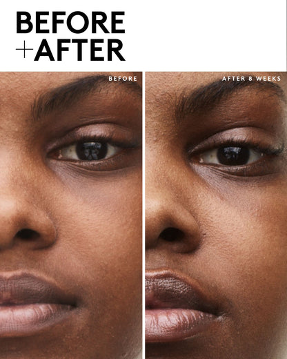 Fenty Skin Travel-Size Start'r Set with Mineral SPF: Dry Skin Edition