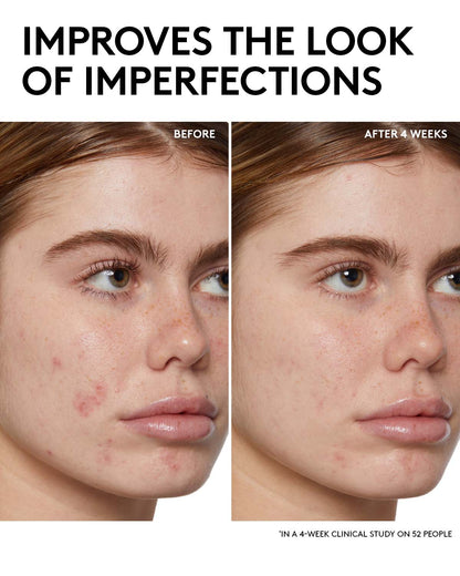Fenty Skin Start’rs Full-Size Bundle: Oily Skin Edition