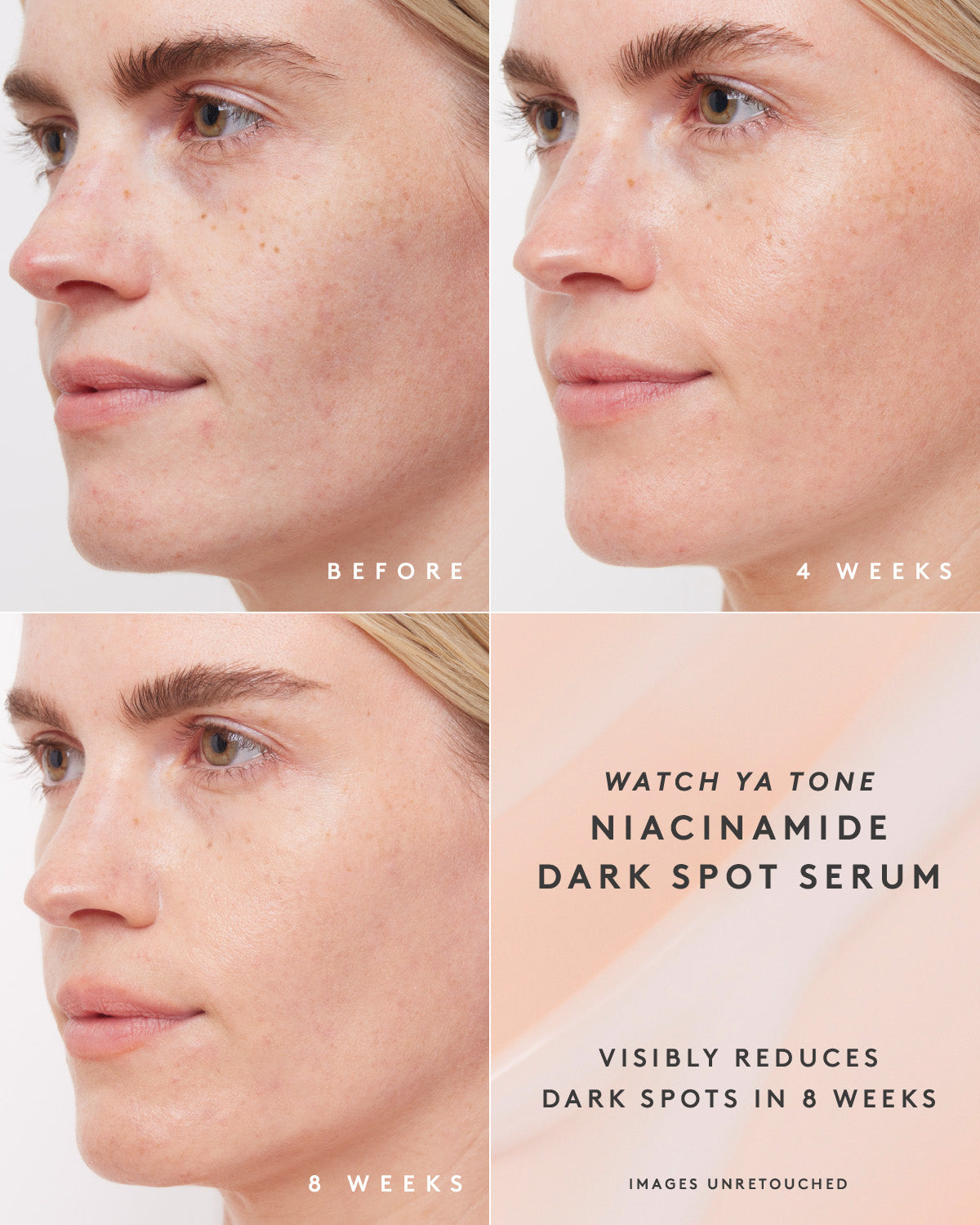 Watch Ya Tone Niacinamide Dark Spot Serum