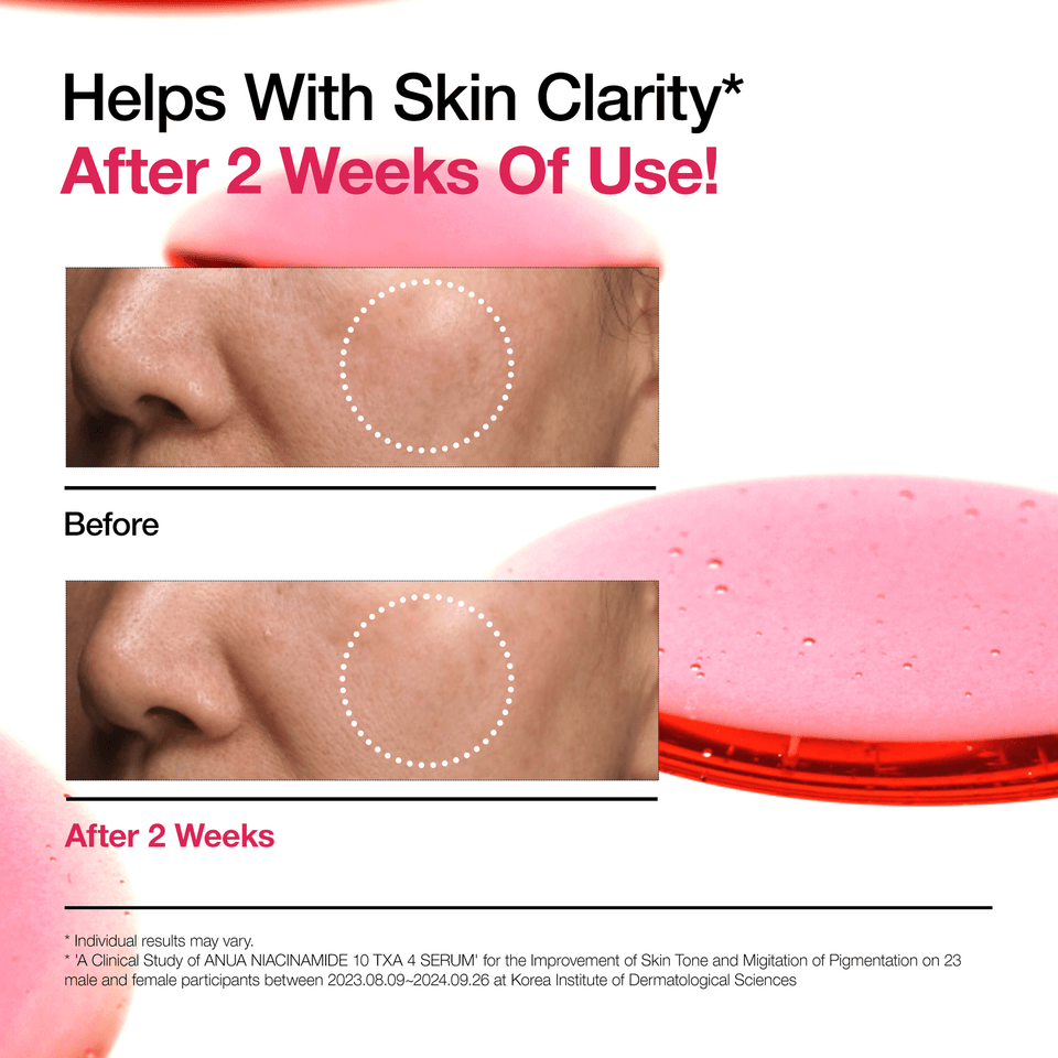 NIACINAMIDE 10%+TXA 4% Dark Spot Serum